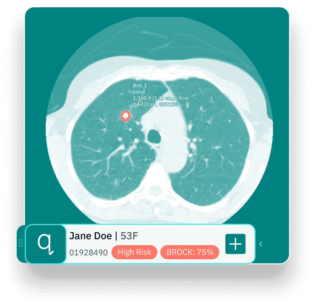 Lung Cancer Suite