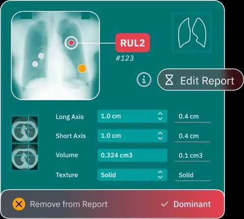qCT: Risk & Quantification