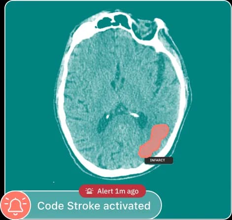 qER (Emergency Suite)